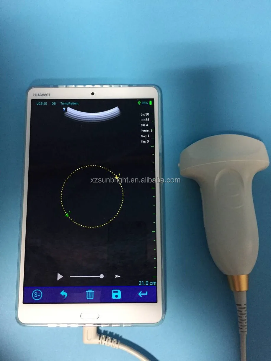 Прямой Производитель USB Ультразвуковой сканер для мобильных телефонов android