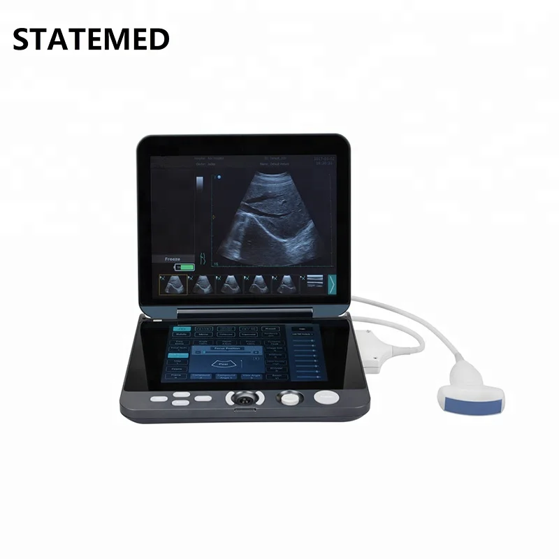 VET Portable Veterinary Ultrasound Machine Scanner
