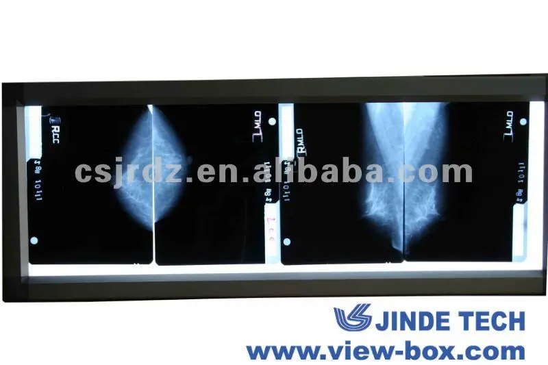 
the high quality LED x ray film viewer Mammography film 