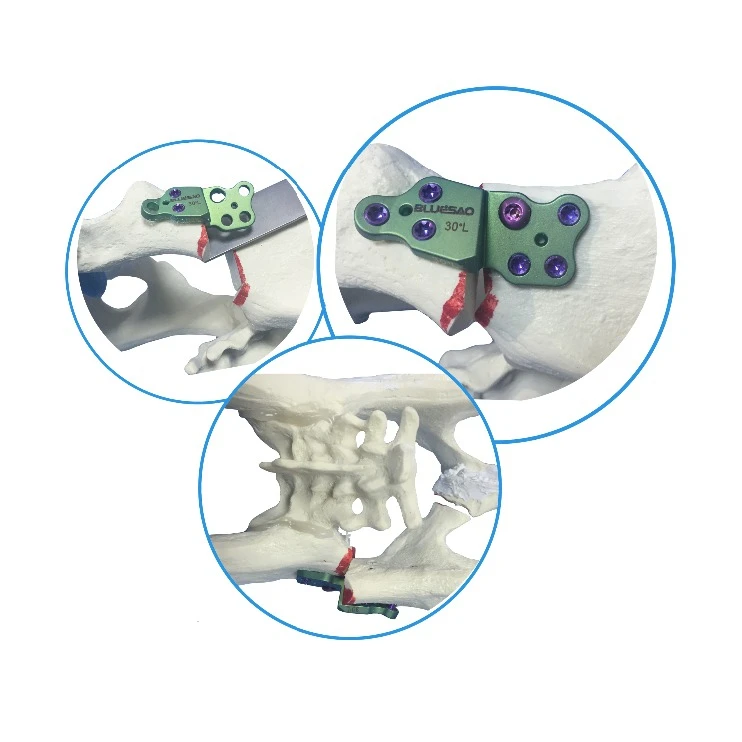 BlueSAO DPO plate 30 degree left&right titanium for veterinary surgery use small animal orthopedic instruments