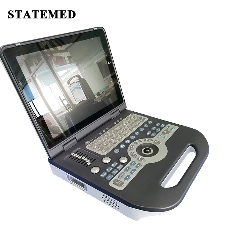 
Extra-long Battery Life Portable Pregnancy Laptop Ultrasound Doppler, 4D Pregnancy Baby Gender Image 