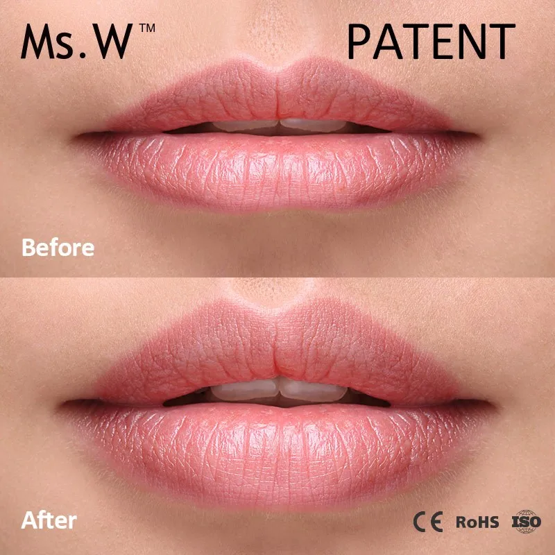 Best Selling lip Products Beauty in USA Electric Ion Vibrating Lip Beauty Care Massager Lip Gloss exfoliate device