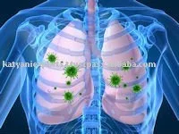 Aromatherapy Blend Oil Four Thieves Oil Blend