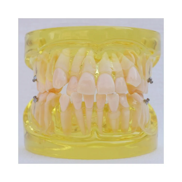 dental education orthodontic model