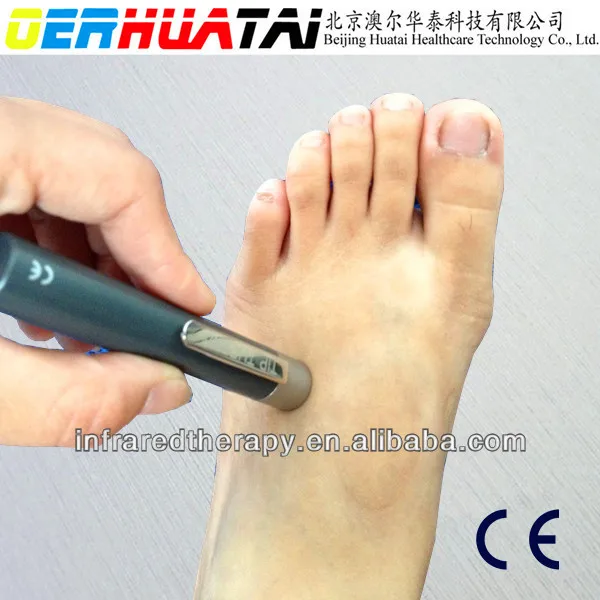 
Neuro-tip Therm for Neuro Testing Medical Equipment for Diabetic Neuro Test Wholesale 