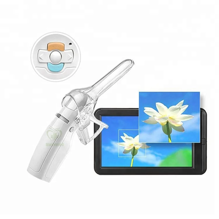 FA2 Self exam mini USB electronic colposcope for women vaginal health MY-F005A