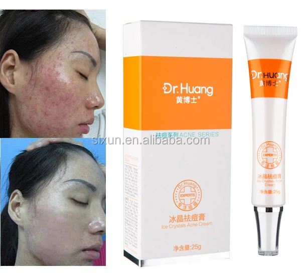 Hot Sale!! Herbal Formula Anti Pimples Beauty Care Acne Melasma Cream
