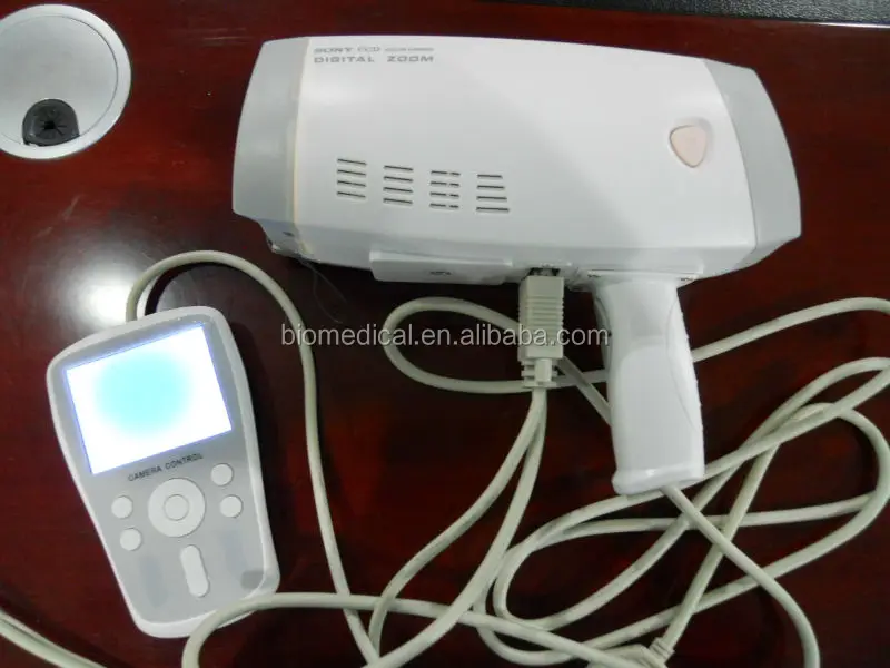 Full ScreenFull HD Camera For Vagina Colposcope Surgical With Low Price