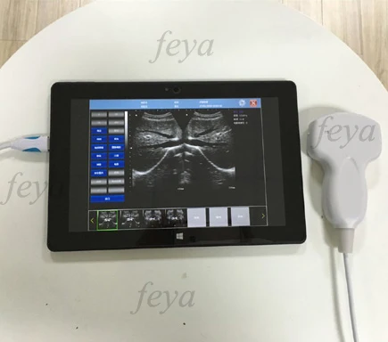 FY-UP-10 IPAD Tablet Mini Ultrasound Scanner