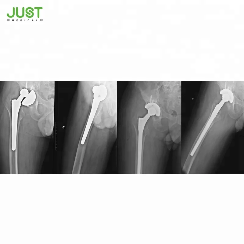 
Zimmer Wagner RSL revision femoral stem Hip Joint Replacement Prosthesis 