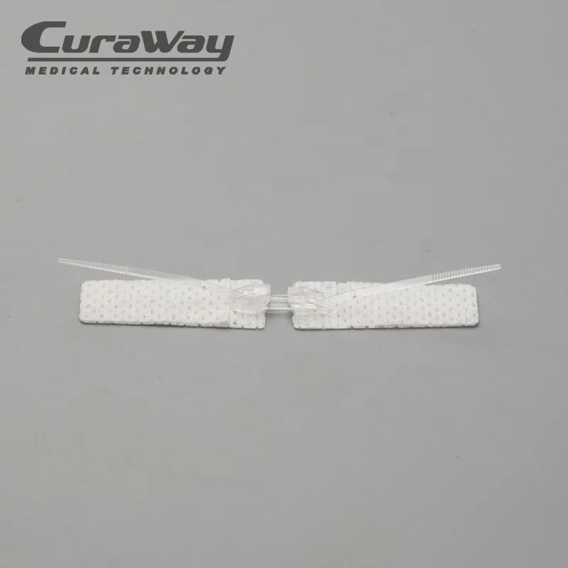 
Noninvasive wound skin closure /Surgcial sutrue device 
