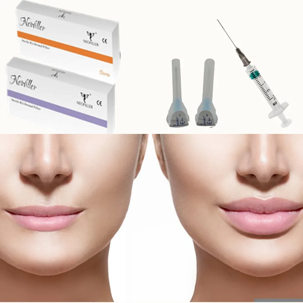 
 Инъекция гиалуроновой кислоты derm для гиалуроновой ручки, 2 мл, быстрая доставка  
