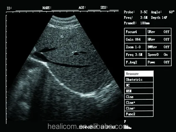 HV-7 Veterinary medical ultrasound instruments Portable Full Digital sheep canine Dog pig ultrasound machine