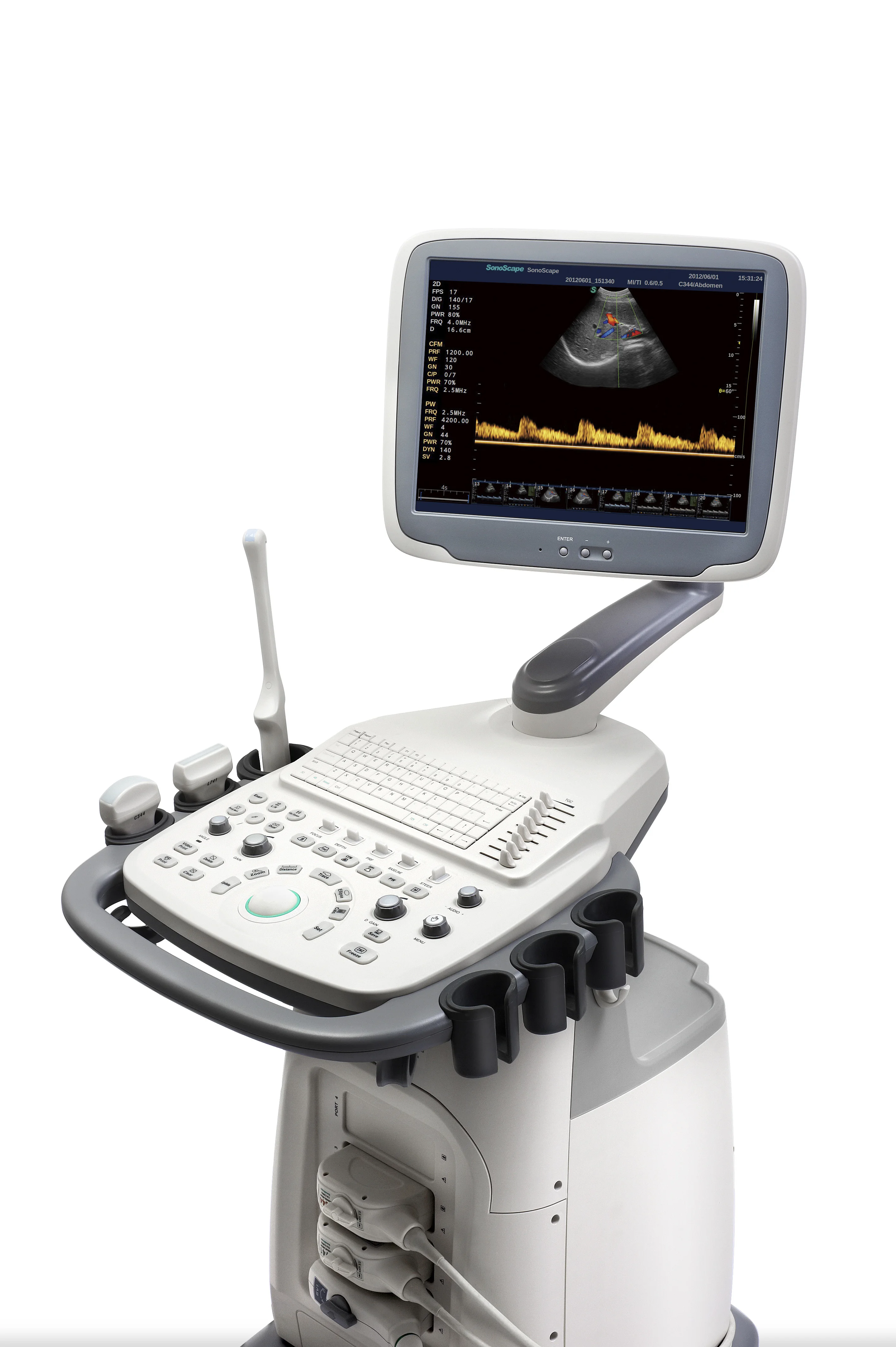 SonoScape S11 Color Doppler Diagnostic Ultrasonic Medical Equipment