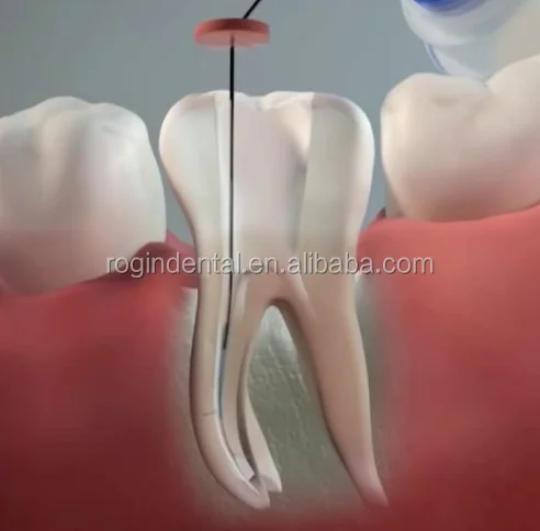 21mm 25mm Root Canal Endo Files for Endo Motor use Reciprocate dental files