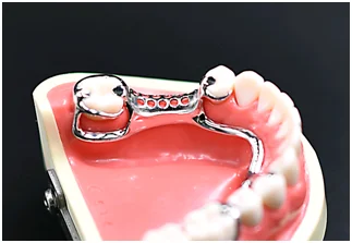 
3d printed dental frame 
