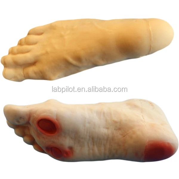 Высококачественная модель симулятора кормления диабетических ног