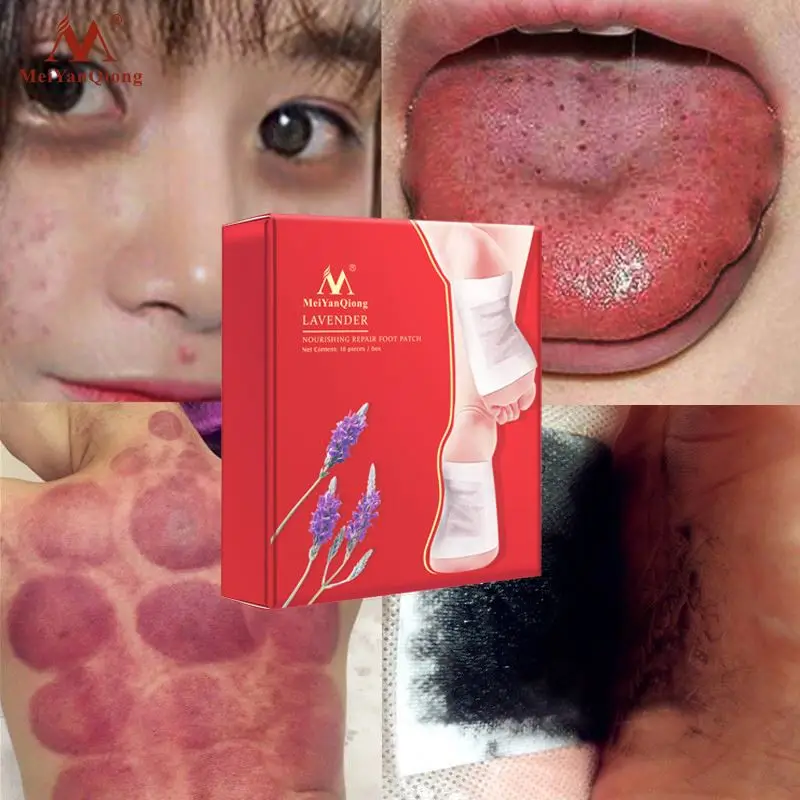 Detox Foot Pads Healthcare Supply Organic Herbal Cleansing Patches Healthy Slimming Foot Sticker