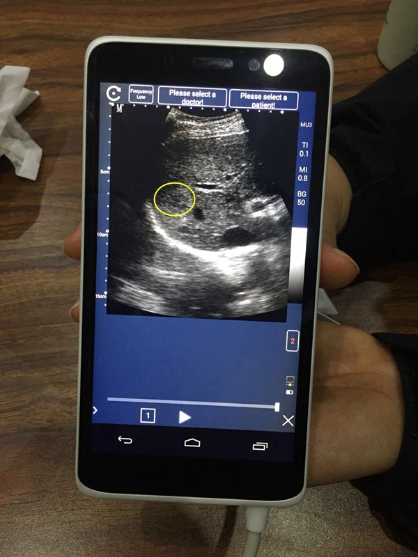 TOP-A1025 portable 4d color doppler ultrasound scanner system usb