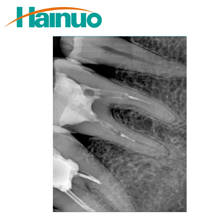 F100 Intraoral Digital Dental Panoramic Wireless X-Ray Senso Machine