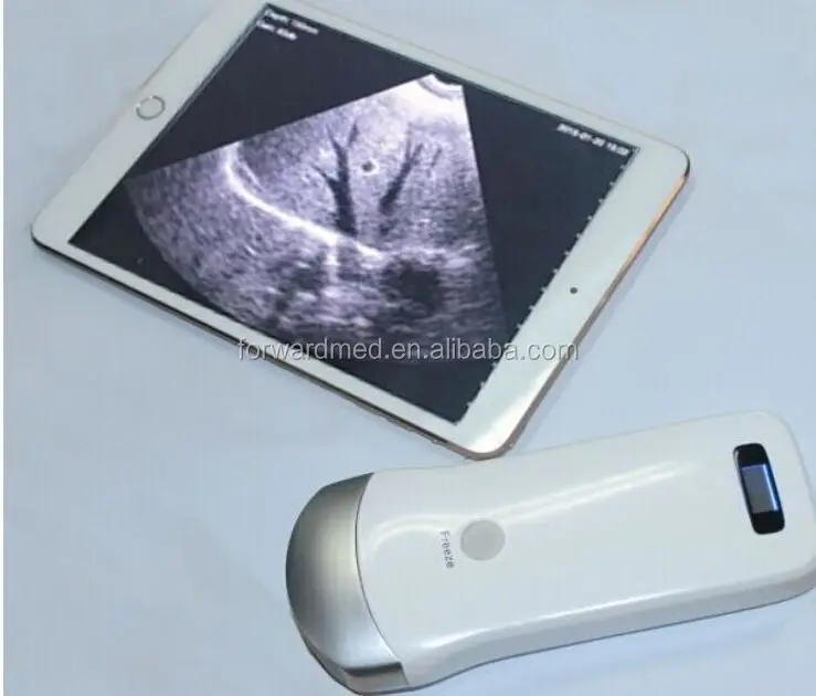 Ультразвуковой сканер для ipad