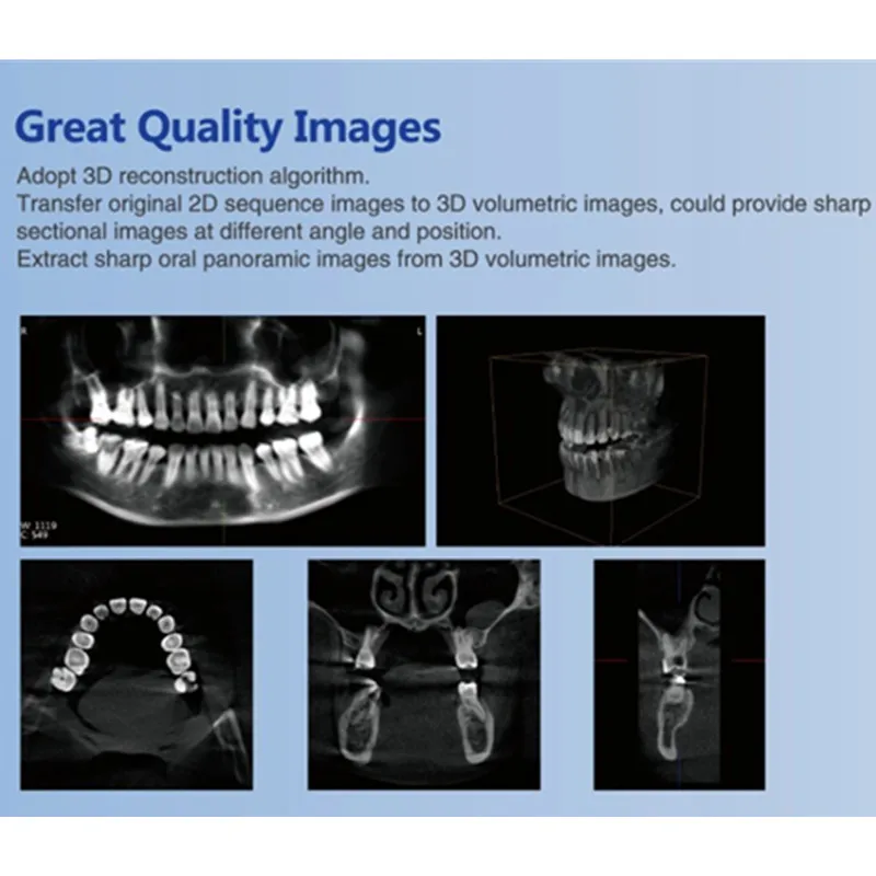 Dental CBCT Digital Dental X Ray Machine  for Oral and maxiloacial Surgery