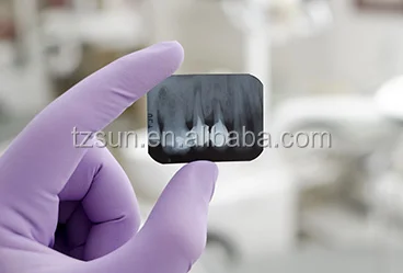 
Display digital x-ray sensor for sale dental supply 