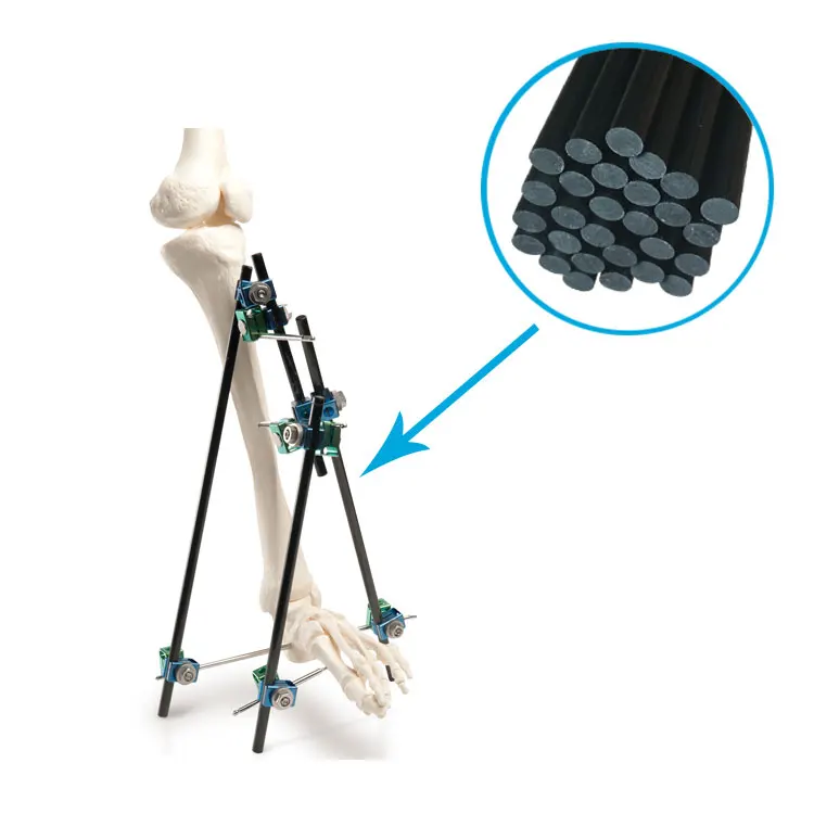Large Bone Temporary External Fixation System 5mm 8mm 11mm 12mm carbon fiber rods