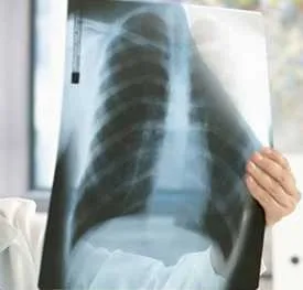 Agfa x-ray film 14*17 / Konica Sdq Dry Laser Medical X-Ray Film Sd-Q