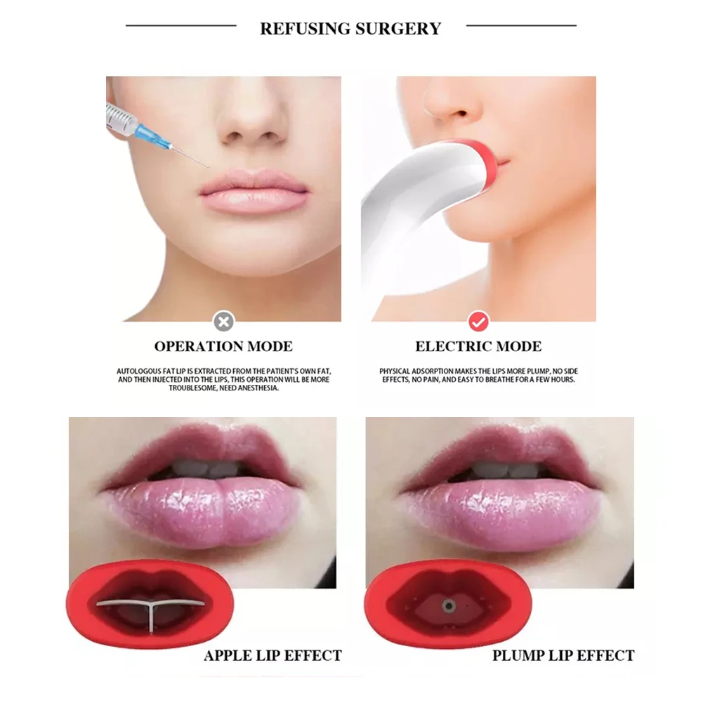 Private Label Silicone Electric Vibrating Lip Plumper Device Enhancer In  Lip Plumper Tool lip plumper device enhancer