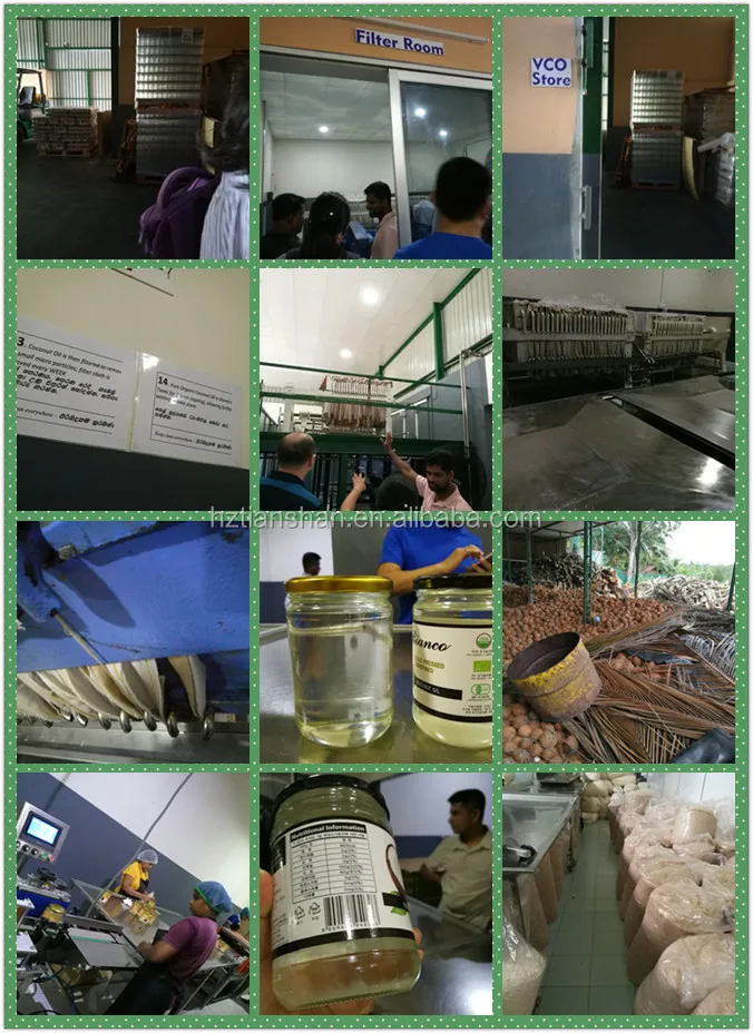 Пищевой высококачественный мешок, микронный фильтр, корпус, масляный фильтр, машины для приготовления пищевого масла/растительного масла