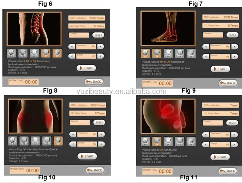 Li-eswt shockwave ed 1000 shock wave therapy buy erectile dysfunction extracorporeal shock wave therapy equipment sw8