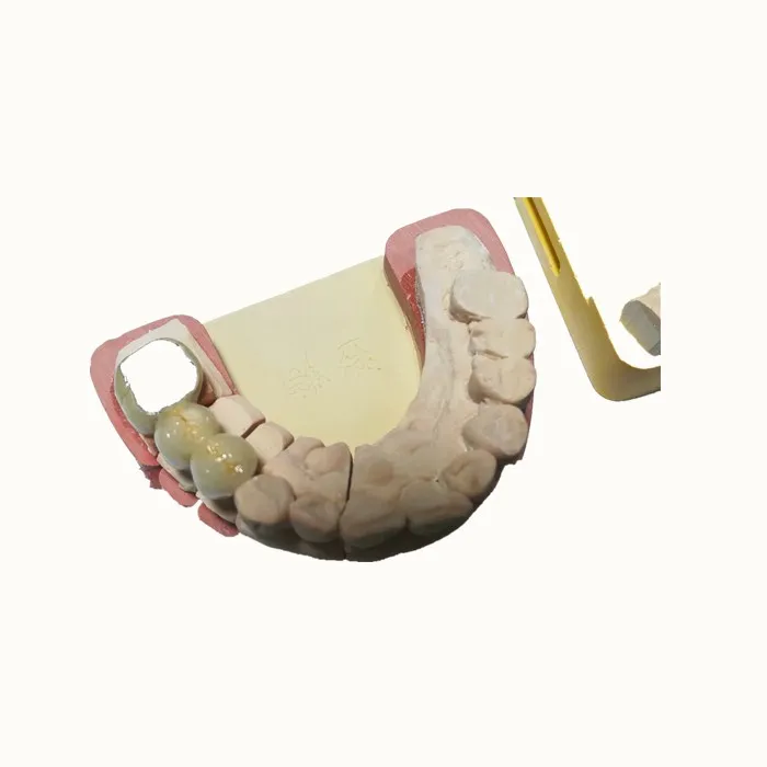 
Good metal and porcelain false teeth 