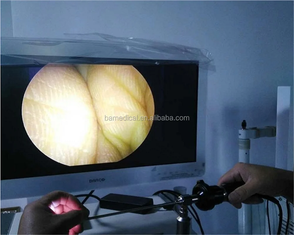 Hospital ENT nasal endoscope 0 30 70 degree/ent endoscopic instruments made in China