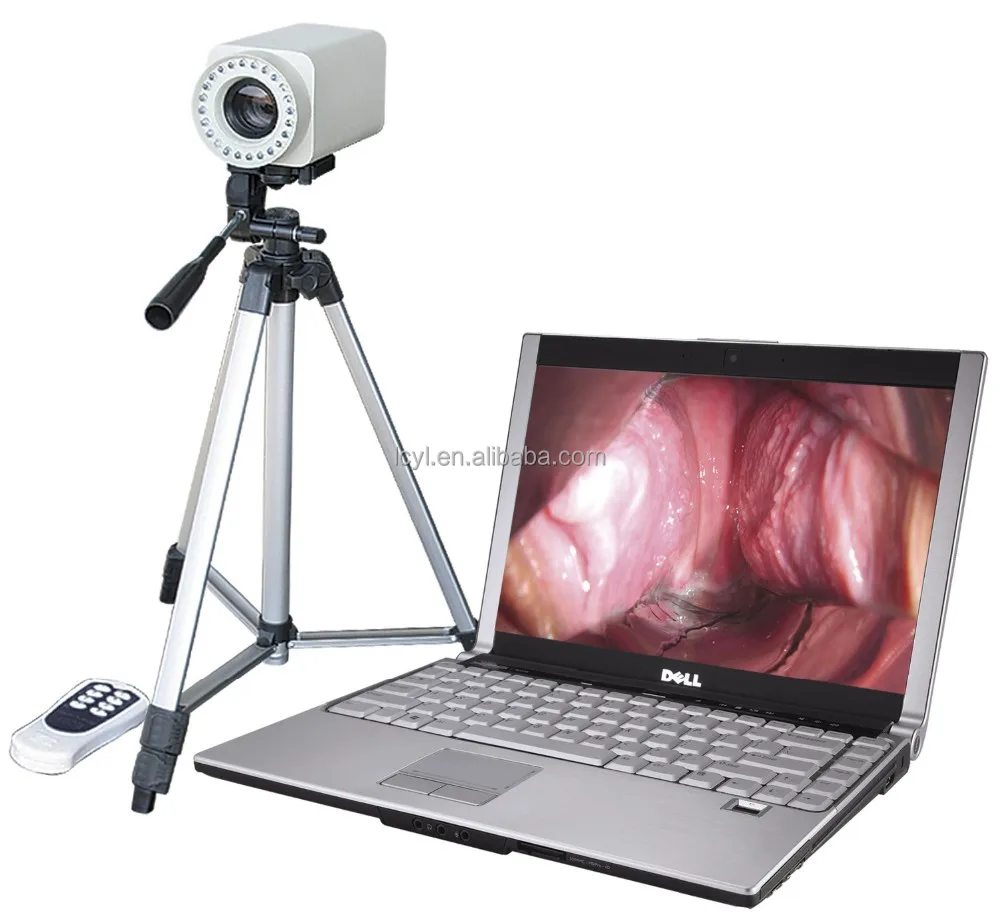 Digital Video Portable Vagina Colposcope camera Sony CCD