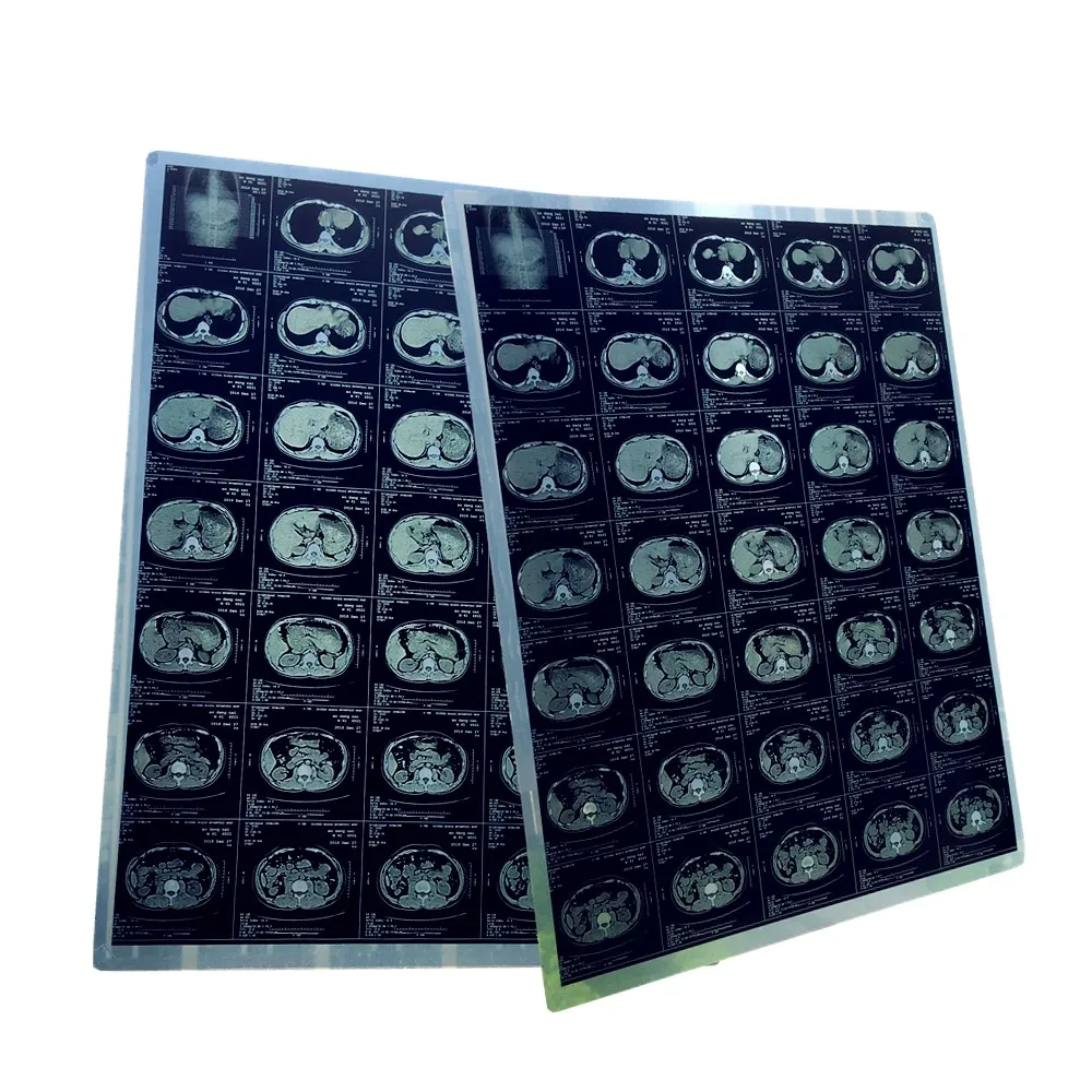 Thermal medical X-ray film for mri/cr/ct scan