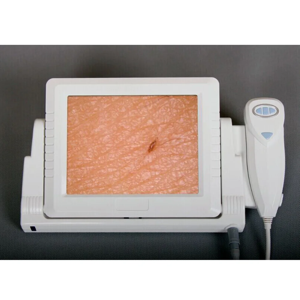 J015(CE) professional skin analyzer for hair and skin iris microscope