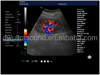 Доплеровская с жилеты зонд ultrasonido 3D DW-VET8P и цветной допплер