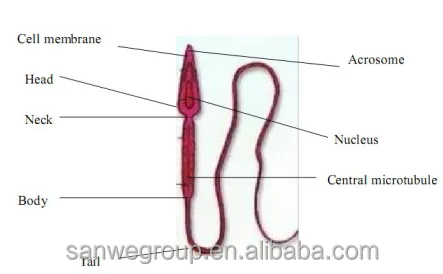 SW-3702  Portable Laptop Semen Analyzer