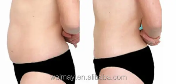 portable lymphatic drainage presoterapia air pressure pressotherapy detox slimming machine