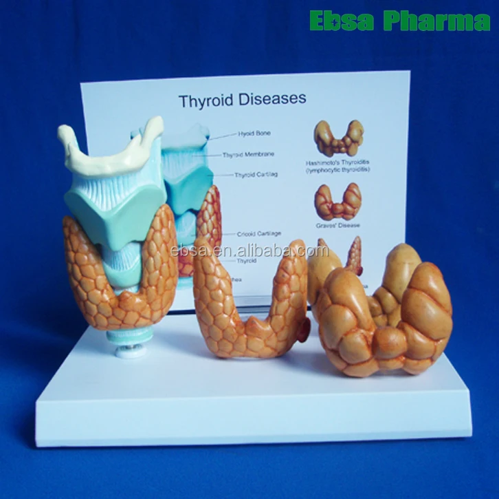 Advanced Medical Supplies Human Teaching Thyroid Disease Anatomical Model For Medical School