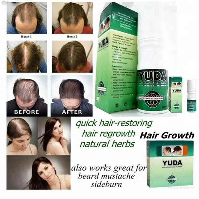 HOT Selling YUDA Pilatory Hair Growth 60ML*3 bottle  Organic Hair Regrowth Oil Best in Hair Treatment