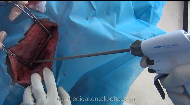 
Ultrasonic Scalpel 