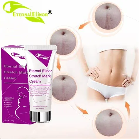 Крем Для Удаления растяжек, гель для взрослых, женский крем для отбеливания, индивидуальная этикетка, уход за кожей, OEM 3 года, 100 г, 10 шт.