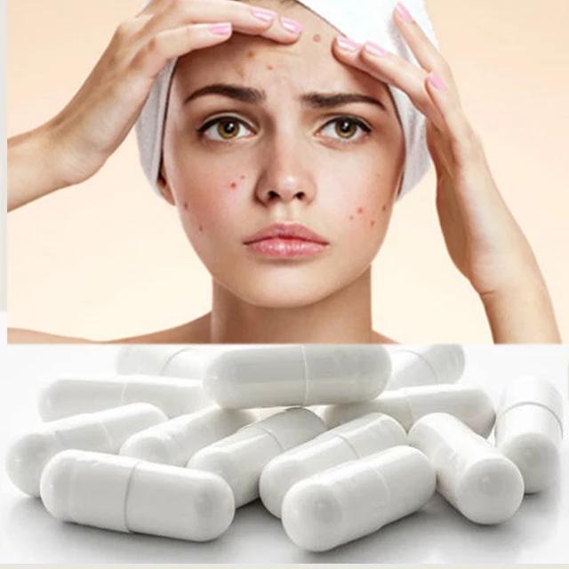 Herbal Effective Anti Acne Skin Whitening Honeysuckle Gluta thione Pills Capsules