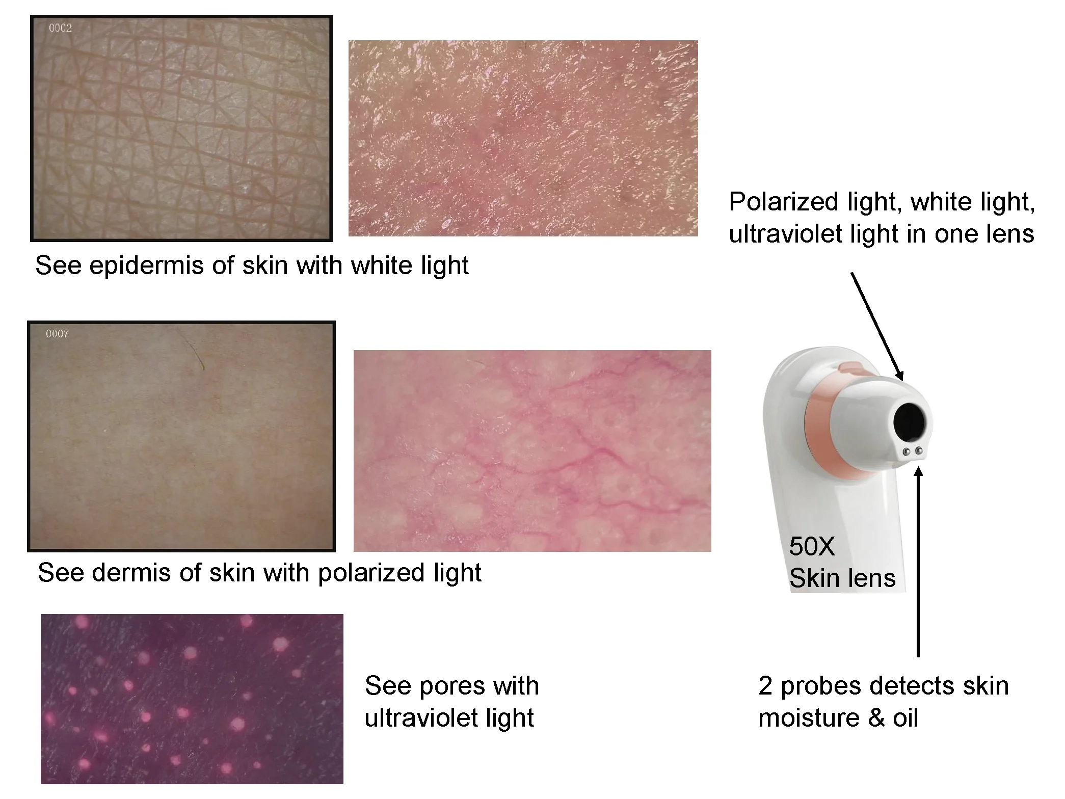 MLG BM-999 Skin Analyzer Camera Medical 50X and 200X Lens For Skin Hair Camera For Beauty Salon Clinic