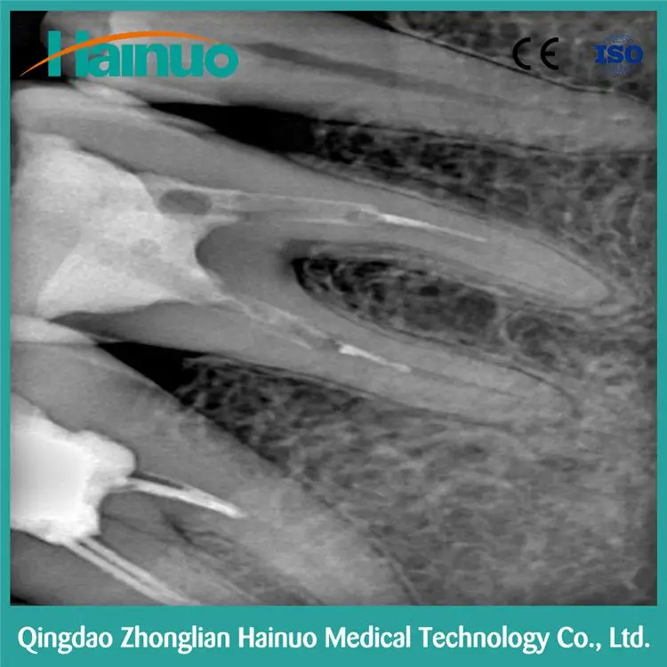 Китай F100 Интраоральной Цифровой X-ray 3D Стоматологических Изображений