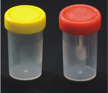 RENONLAB Manufacturer Of Disposable Medical Urine Specimen Collection Container Cup