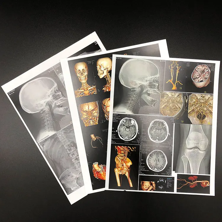 
Medical Radiation Laser Printing Film for Hospital Use 