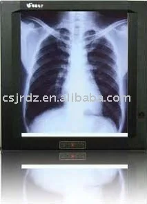 
Medical x ray film viewers 